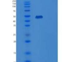 人白细胞免疫球蛋白样受体B2/LILRB2/ILT4/CD85d重组蛋白C-6His
