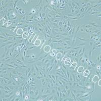 KTC-1 人甲状腺癌细胞/KTC-1/KTC-1细胞/KTC1细胞/KTC1/STR鉴定/镜像绮点（Cellverse）