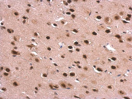 DDX1 Antibody - middle region (OAGA02498) in Rat fore brain using Immunohistochemistry