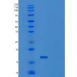 人B-细胞激活因子(BAFF)重组蛋白