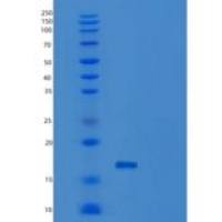 人B-细胞激活因子(BAFF)重组蛋白