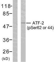 ATF2 Antibody (Phospho-Ser62 or 44) (OAAF07677) in HeLa using Western Blot