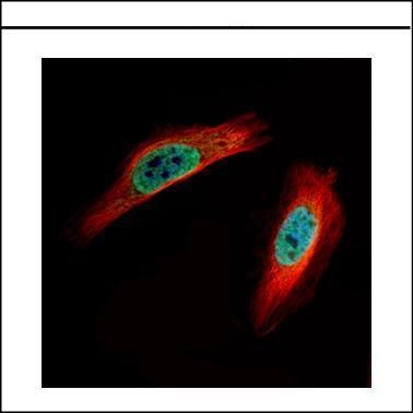 CLIC4 Antibody (OAGA02428) in Paraformaldehyde-fixed Hela using Immunofluorescence