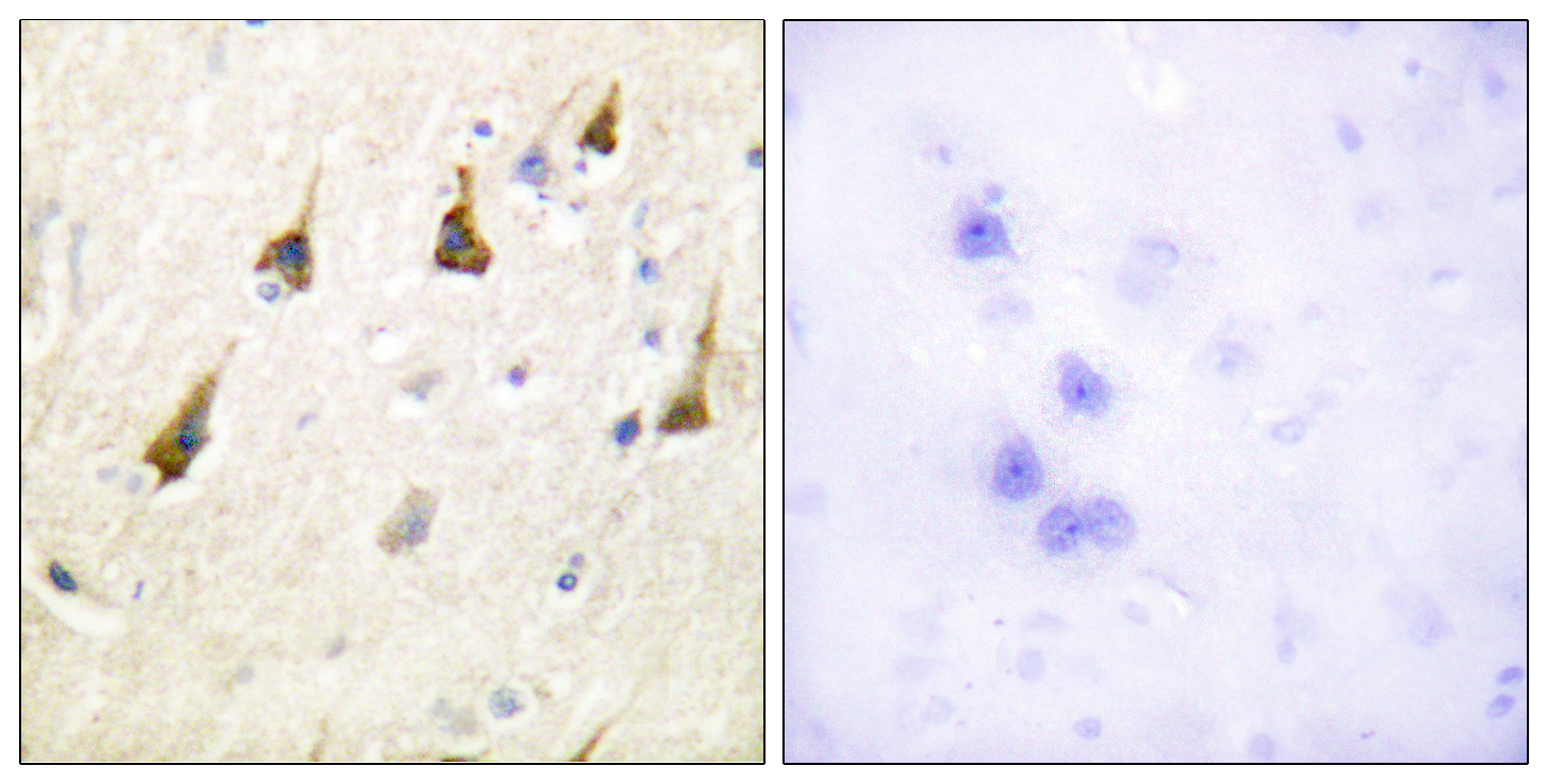 SENP7 Antibody (OAAF01965) in human brain tissue using Immunohistochemistry.