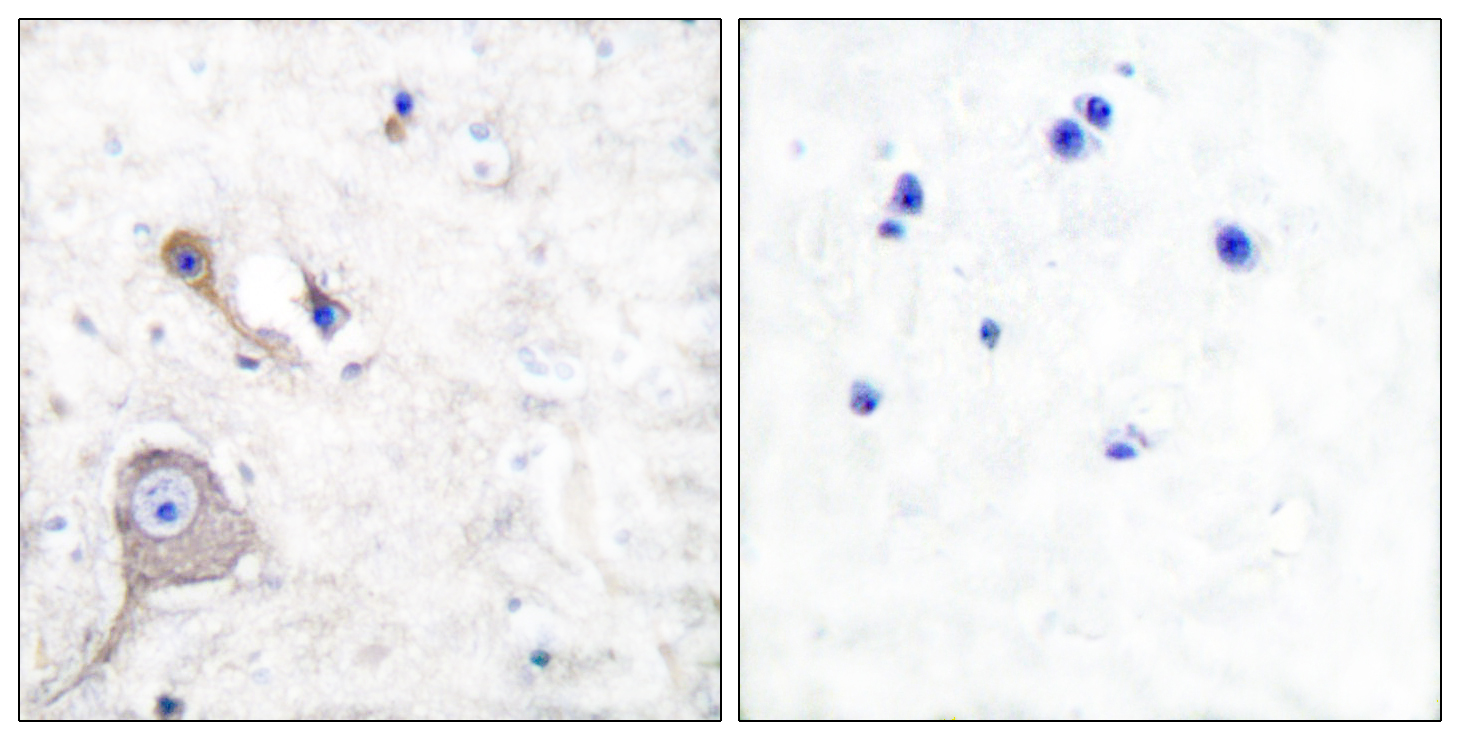 S100A1 Antibody (OAAF01918) in human brain tissue using Immunohistochemistry.