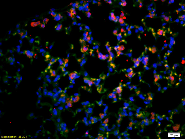 CD4 Antibody (OABF00238) in Rat lung using Immunohistochemistry