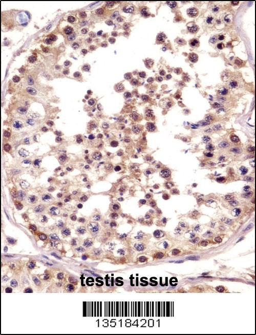 TSPY1 Antibody - C-terminal (OAAB17814) in Human testis tissue using Immunohistochemistry