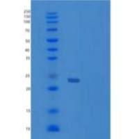 人脊椎蛋白2(SPON2)重组蛋白C-6His