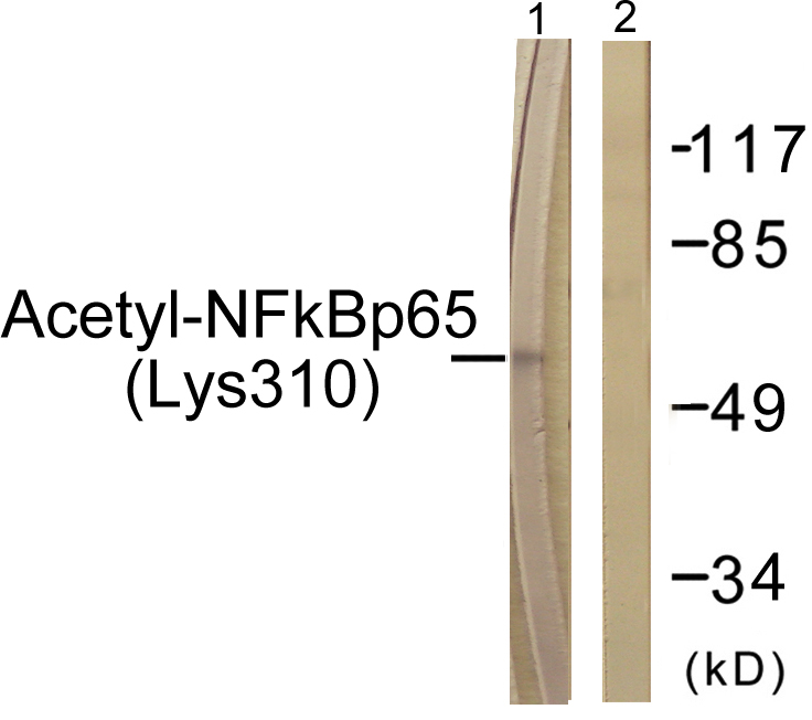 NF-kappaB p65 Antibody (Acetyl-Lys310) (OAAF08188) in HeLa using Western Blot