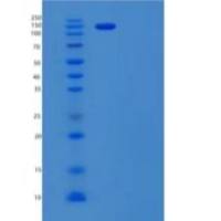 人锯齿状-1重组蛋白