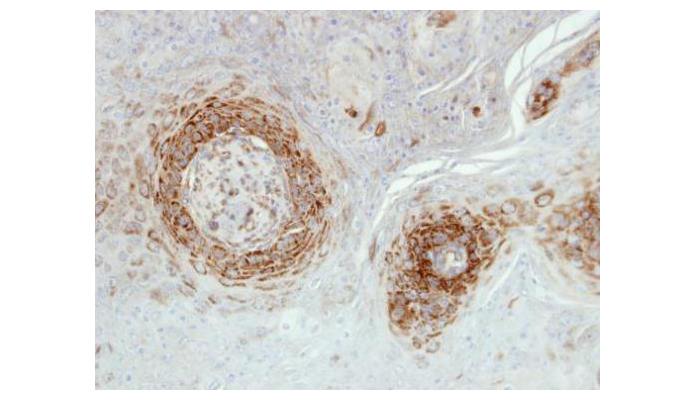 NDUFA5 antibody (OAGA00879) in Cal27 Xenograft using Immunohistochemistry