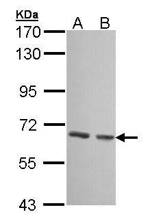 GCKR Antibody (OAGA02215) in 293T, A431 using Western Blot
