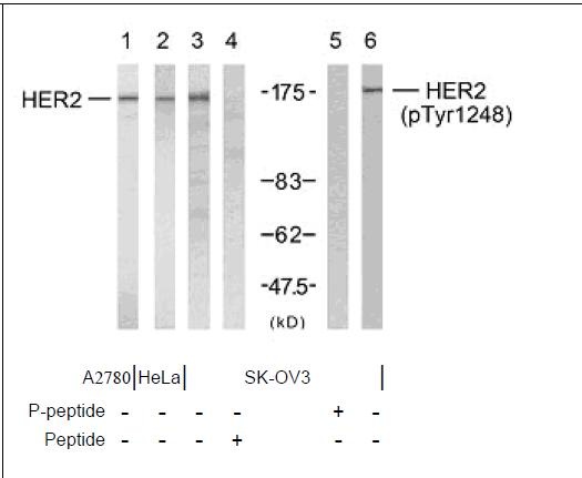 HER2 (Ab-1248) Antibody (OAEC00422) in HER2 (Ab-1248) using Western Blot