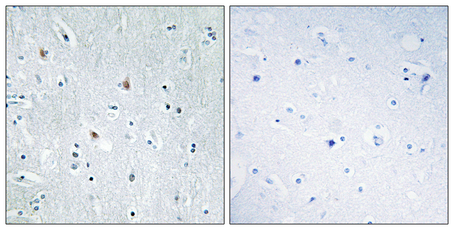 SOX12 Antibody (OAAF02016) in human brain tissue using Immunohistochemistry.