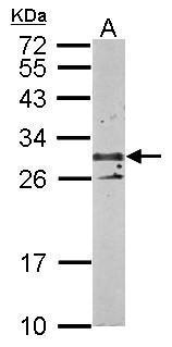 TSPAN3 Antibody (OAGA02810) in Mouse kidney using Western Blot