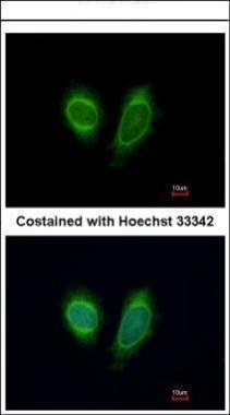 DDX1 Antibody - middle region (OAGA02498) in Methanol-fixed Hela using Immunofluorescence
