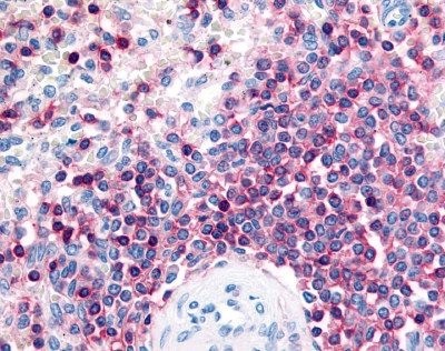 PTPRC Antibody (OAEG00599) in formallin fixed paraffin embedded spleen, lymphocytes using Immunohistochemistry