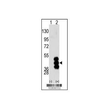 PHKG2 antibody - N - terminal region (OAAB17009) in 293 using Western Blot