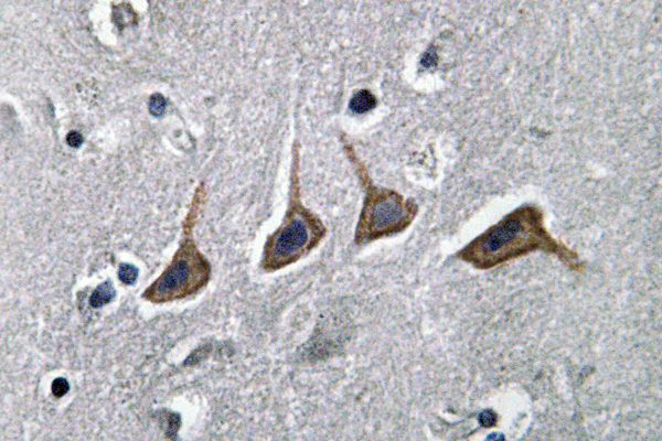 OAT1 Antibody (OAAF05885) in human brain tissue using Immunohistochemistry.