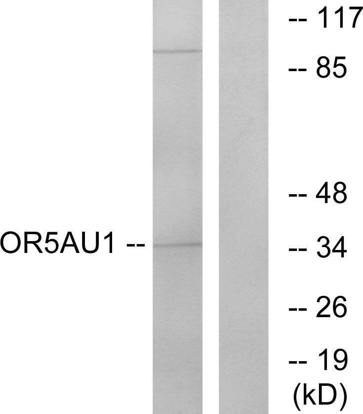 OR5AU1 Antibody (OAAF05053) in Jurkat using Western blot.