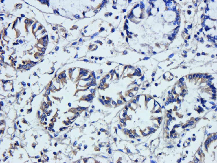 VEGF165 Antibody (OABI00020) in Pig lung tissue using Immunohistochemistry