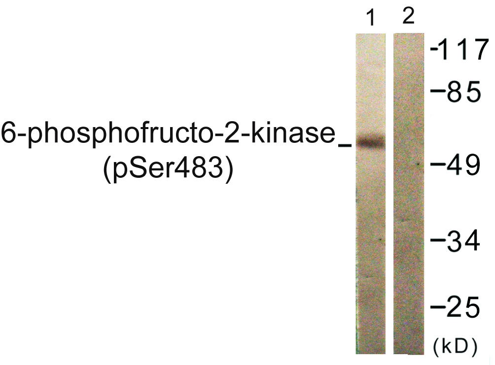 PFKFB2 Antibody (Phospho-Ser483) (OAAF07506) in 293 using Western Blot