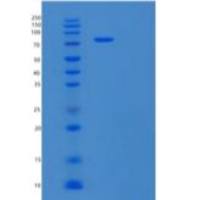 人巨噬细胞集落刺激因子受体(MCSFR)重组蛋白C-Fc