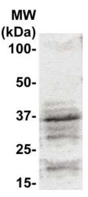 Rabbit Anti-Cyclin G1 Polyclonal Antibody(OAAI00026) in MCF-7  using Western Blot.