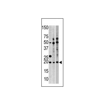 RPL23A antibody - C - terminal region (OAAB14977) in CEM, Hela, HepG2 using Western Blot