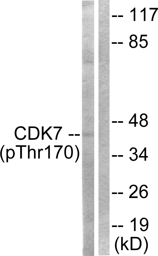 CDK7 Antibody (Phospho-Thr170) (OAAF00180) in HeLa using Western blot.