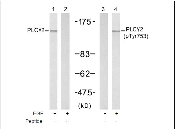PLC2 (Ab-753) Antibody (OAEC00528) in A431 using Western Blot