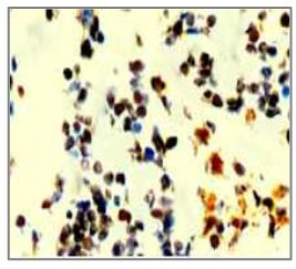 Rabbit Anti-P53 Antibody (Phospho-Ser37)(OAAI00469) in UV treated Hela using Immunohistochemistry.