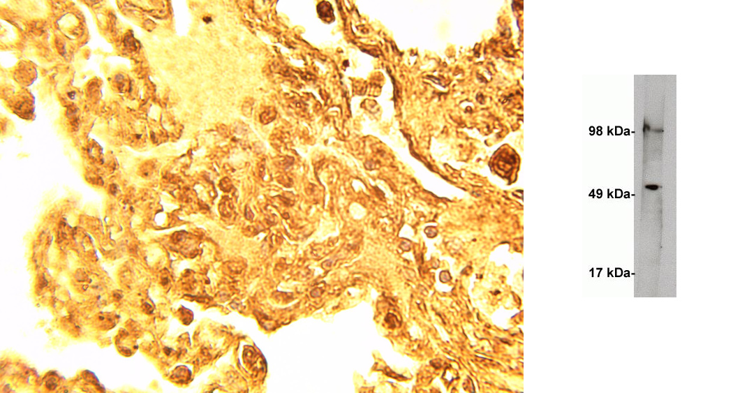 SPTLC1 Antibody (OAEG00398) in normal human lung tissue, human kidney lysate using Western Blot