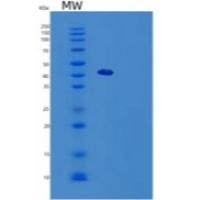 人B-细胞激活因子(BAFF)重组蛋白Fc tag