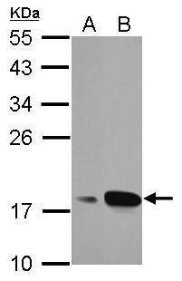 AGR3 Antibody (OAGA01334) in A549 using Western Blot