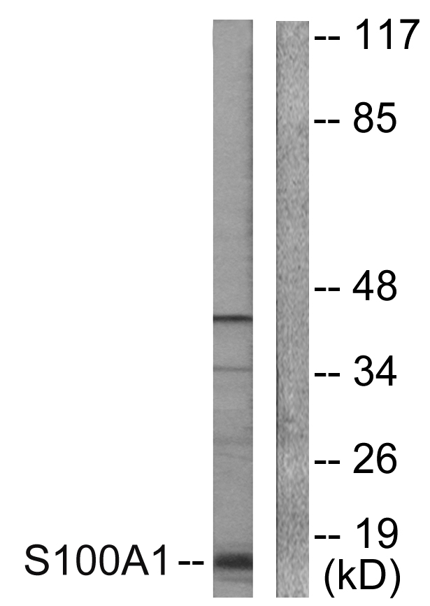 S100A1 Antibody (OAAF01918) in A549 using Western blot.