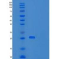 人重肽铁蛋白(FTH)重组蛋白