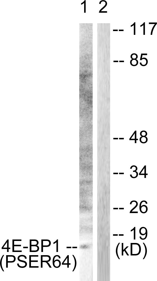 EIF4EBP1 Antibody (Phospho-Ser64) (OAAF00067) in Jurkat using Western blot.