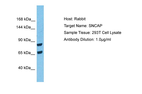 SNCAP Antibody (ARP75263_P050) in Human 293T Whole Cell using Western Blot