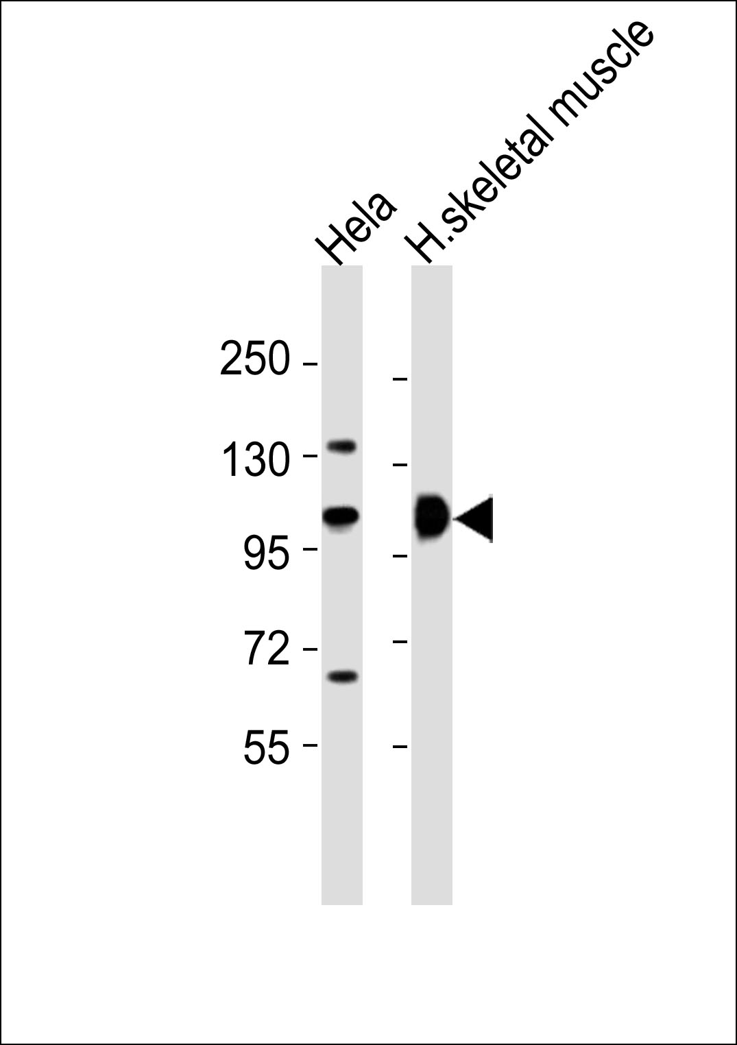 ACTN2 Antibody (OAAB19593) in Hela whole cell lysates, human skeletal muscle lysates using Western Blot