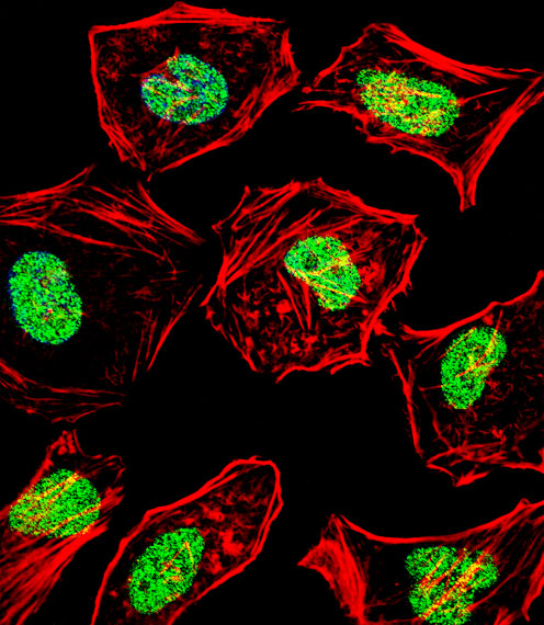 HAND2 Antibody (Center) (OAAB12422) in Hela using immunofluorescent