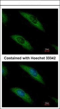 ALDOB Antibody (OAGA01567) in Methanol-fixed Hela using Immunofluorescence