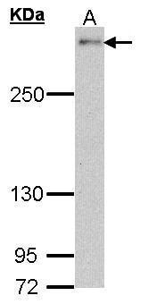 NOTCH2 Antibody - C-terminal region (OAGA01645) in Hela using Western Blot