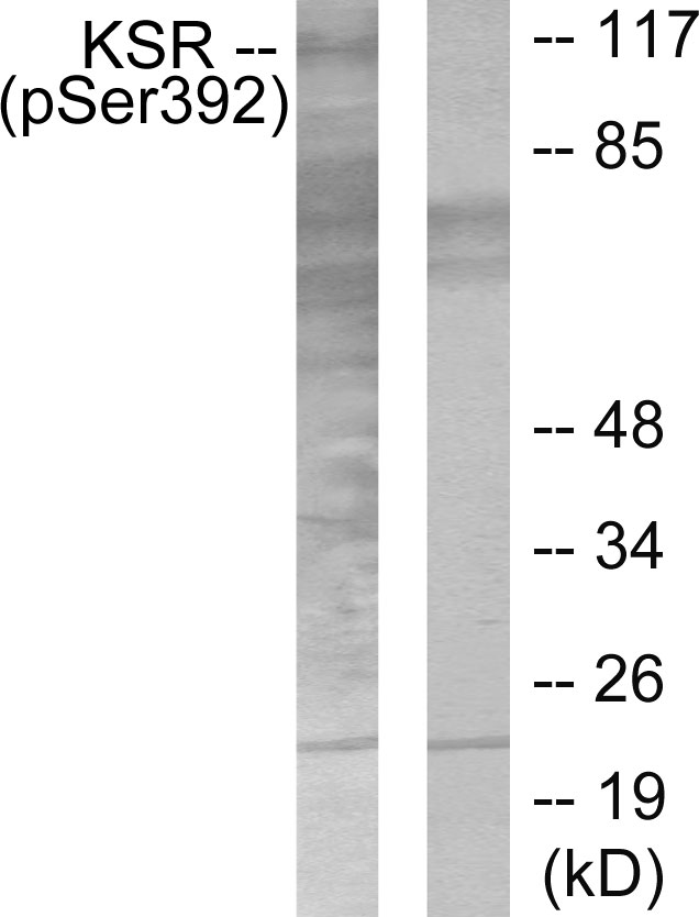 KSR Antibody (Phospho-Ser392) (OAAF07333) in HepG2 using Western Blot