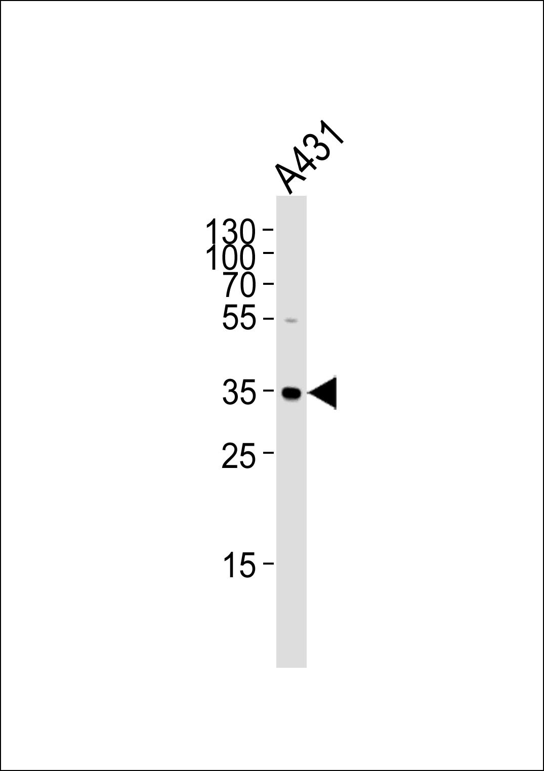 IFNGR2 Antibody (OAAB19527) in A431 cell line using Western Blot