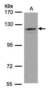 USP11 Antibody - N-terminal region (OAGA01593) in Hela S3 using Western Blot