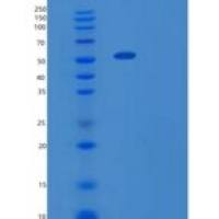 小鼠白细胞介素-2受体亚单位α重组蛋白