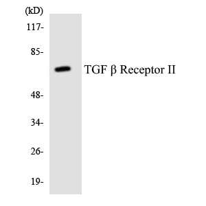 TGF β Receptor II Antibody (OAAF07227) in HT-29 using Western blot.