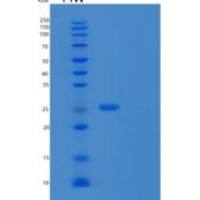 人糜蛋白酶原B1(CTRB1)重组蛋白C-6His