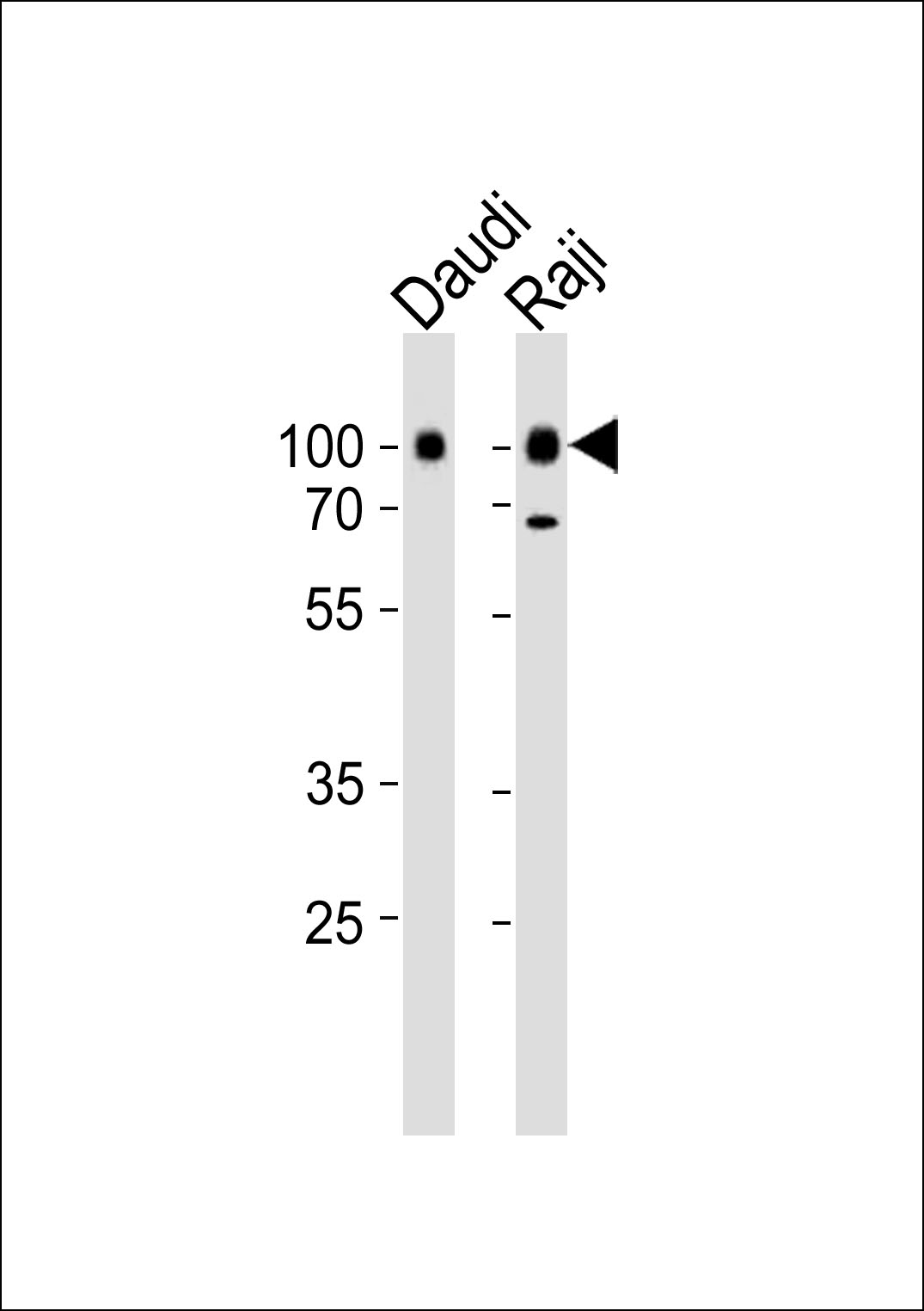 CD19 Antibody - C-terminal region (OAAB18766) in Daudi, Raji cell line using Western Blot